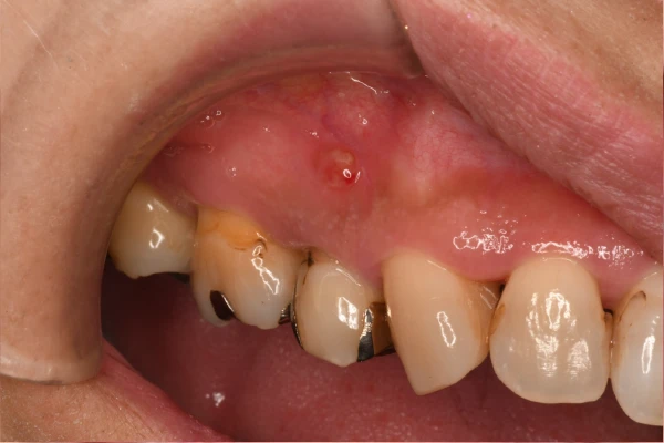 case1　Before