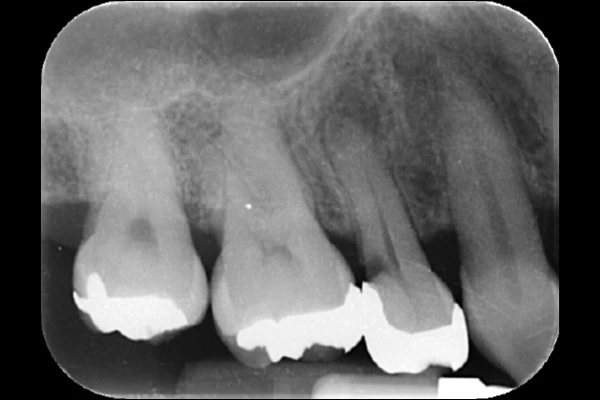 case1 Before