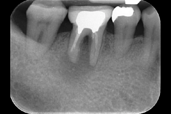 case2 Before