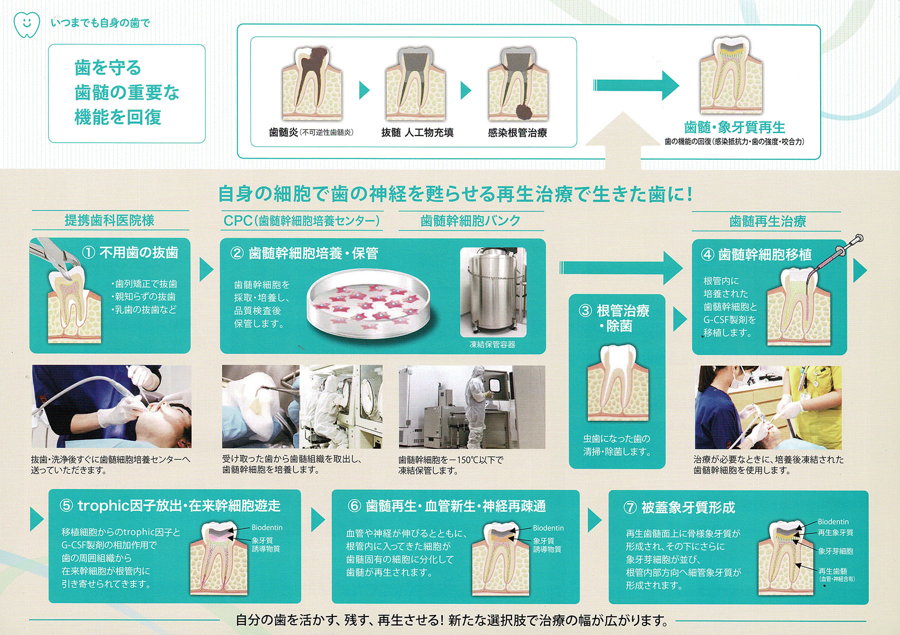 歯髄再生治療 - 東京の根管治療・歯内療法専門医院 | 東京歯内
